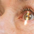Симптомы катаракты и методы лечения